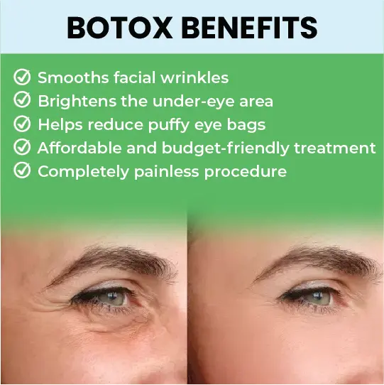 Botox benefits list with before and after eye wrinkle comparison images