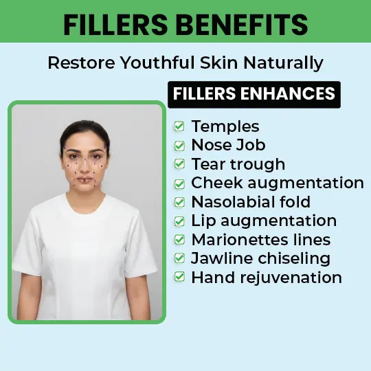 Fillers benefits diagram showing facial enhancement areas and treatment zones