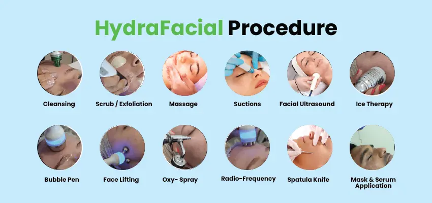 HydraFacial procedure steps showing treatment stages from cleansing to serum application