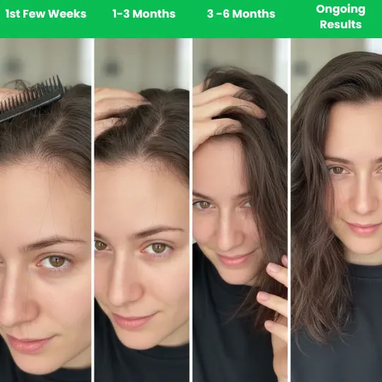 Hair regrowth timeline for women: weeks 1 to 6 months of hair loss treatment