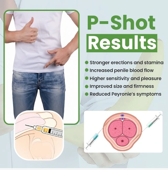 P-Shot treatment benefits infographic showing injection procedure and results