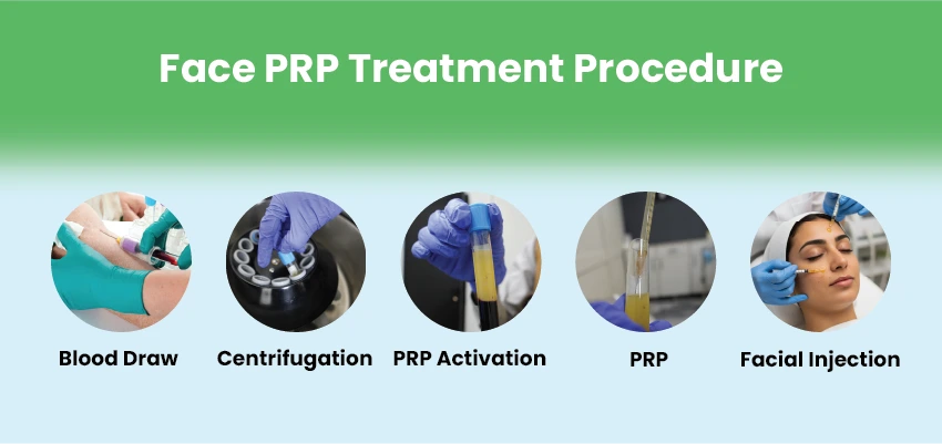 face prp procedure steps