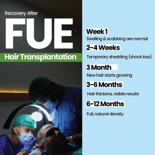 FUE hair transplant recovery timeline from week 1 to 12 months showing growth stages
