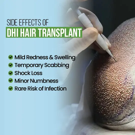 Side effects of DHI hair transplant including mild redness, swelling, temporary scabbing, shock loss, minor numbness, and rare risk of infection.