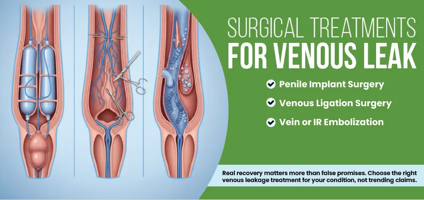 Diagram showing three surgical treatments for venous leak with medical illustrations