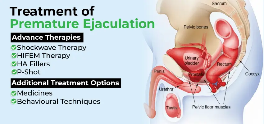 Male pelvic anatomy showing premature ejaculation treatments: shockwave, HIFEM, fillers, P-Shot therapy