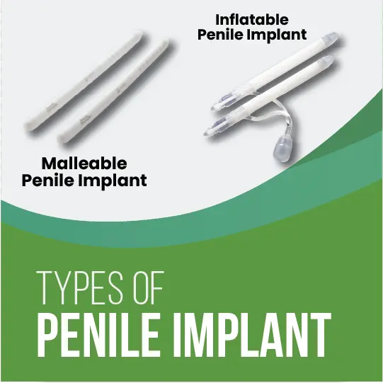 Diagram showing malleable and inflatable penile implant types side by side