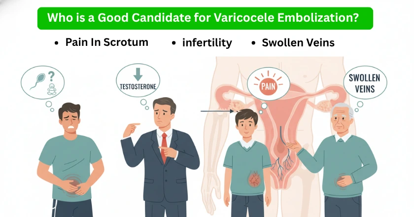 Candidates for varicocele embolization who : scrotal pain, infertility, swollen veins