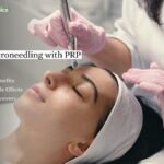 A woman getting micro needling PRP for face by skin specialist