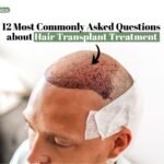 A man having a hair transplant and the 12 most commonly asked about hair loss treatment