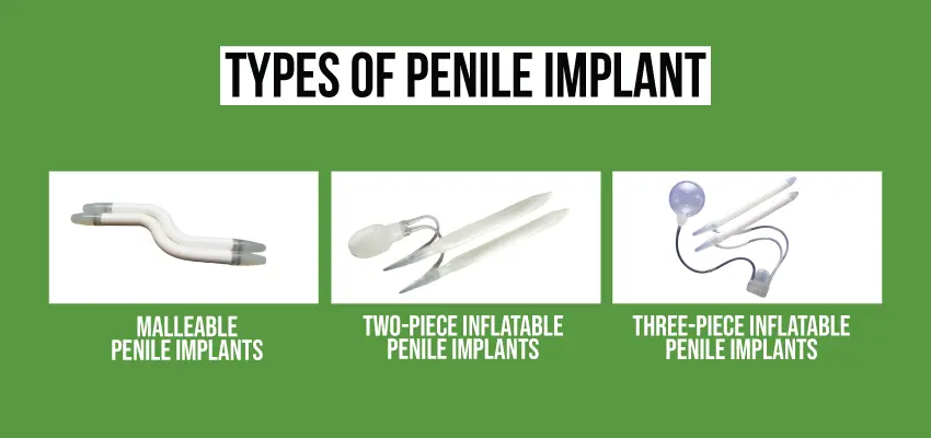 Types of penile implants: malleable, two-piece, and three-piece inflatable implant options.