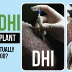 DHI vs FUE hair transplant side-by-side comparison for best results.