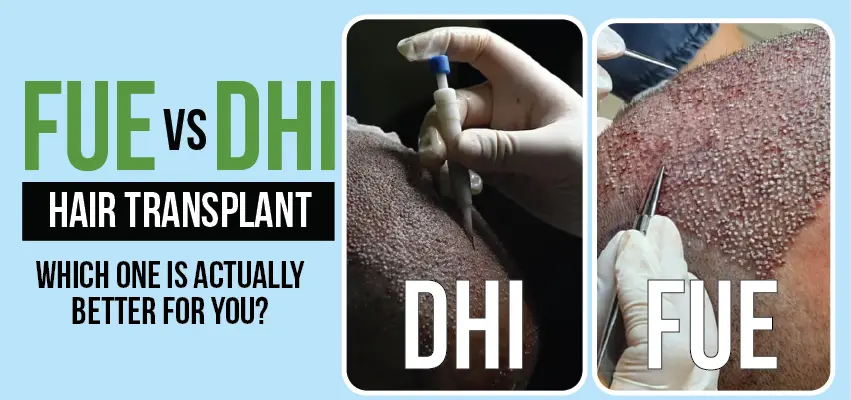 DHI vs FUE hair transplant side-by-side comparison for best results.