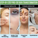 Step-by-step pre-Eid skin transformation guide acne chemical peel hydrafacial glow