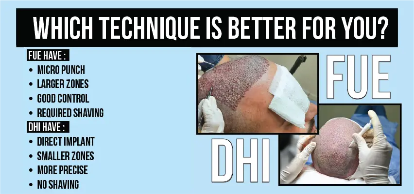 Comparison chart of FUE vs DHI hair transplant techniques and benefits.
