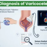 Varicocele diagnosis methods: physical exam, duplex ultrasound, and semen analysis for count and motility