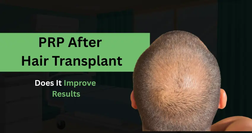 Man with thinning crown and text overlay about PRP benefits after hair transplant.
