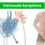 Varicocele symptoms illustration showing enlarged scrotal veins and lower abdominal pain in men