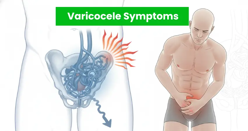 Varicocele symptoms illustration showing enlarged scrotal veins and lower abdominal pain in men