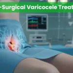 Non-Surgical Varicocele Treatment