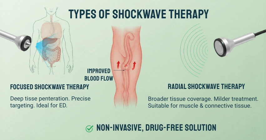 Focused vs Radial Shockwave Therapy for ED – Non-Invasive, Drug-Free Solution for Improved Blood Flow