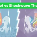 P-Shot injection vs shockwave therapy comparison for erectile dysfunction treatment