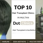 Top 10 Hair Transplant Clinics in Multan