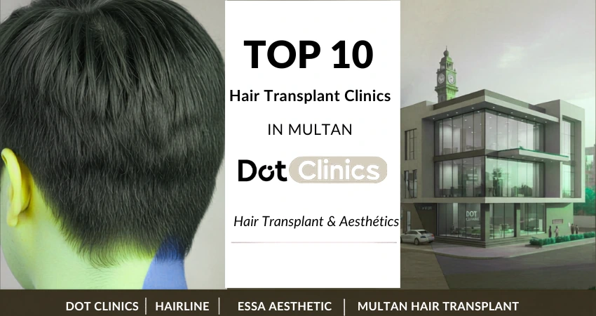 Top 10 Hair Transplant Clinics in Multan